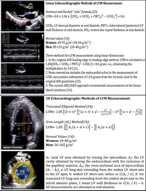 left ventricular mass calculator.